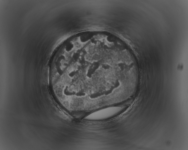 X0000095511171200801041153