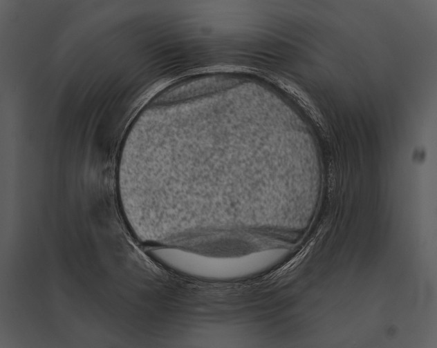X0000095511177200801041153