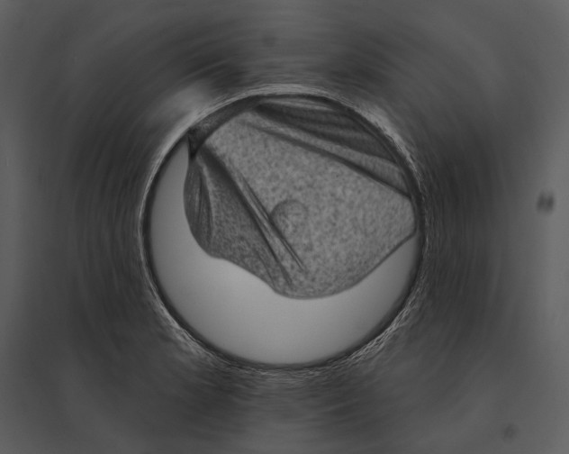 X0000095511181200801041153