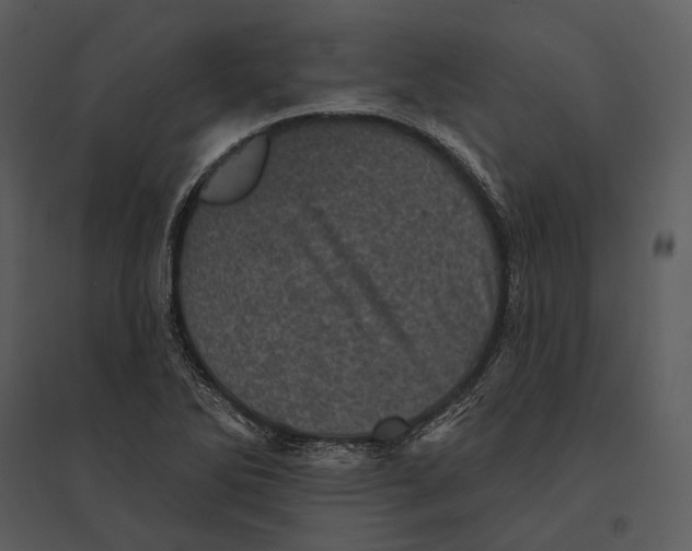 X0000095511270200801041152