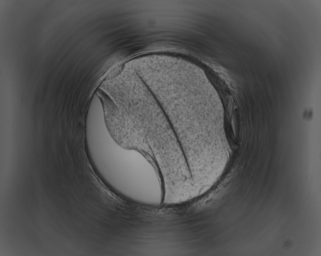 X0000095511369200801041150