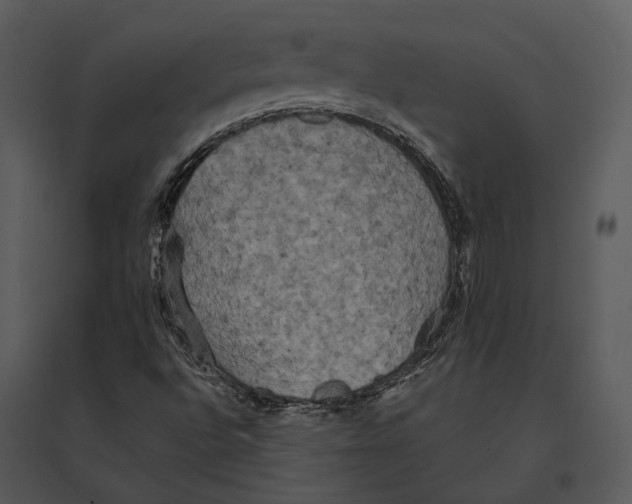 X0000095511496200801041148