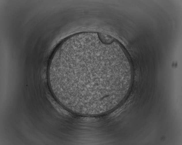 X0000095511499200801041148