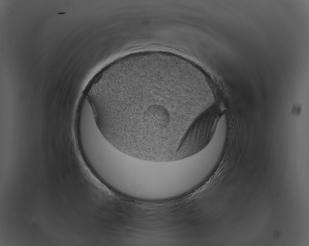 X0000095511518200801041148