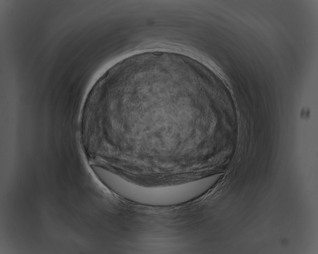 X0000095511536200801041148