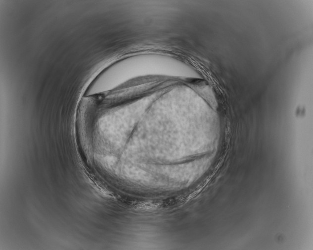 X0000095510148200801111421