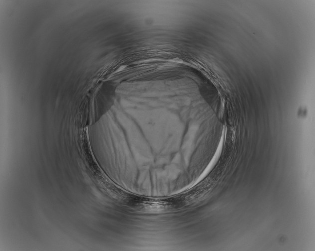X0000095510316200801111419