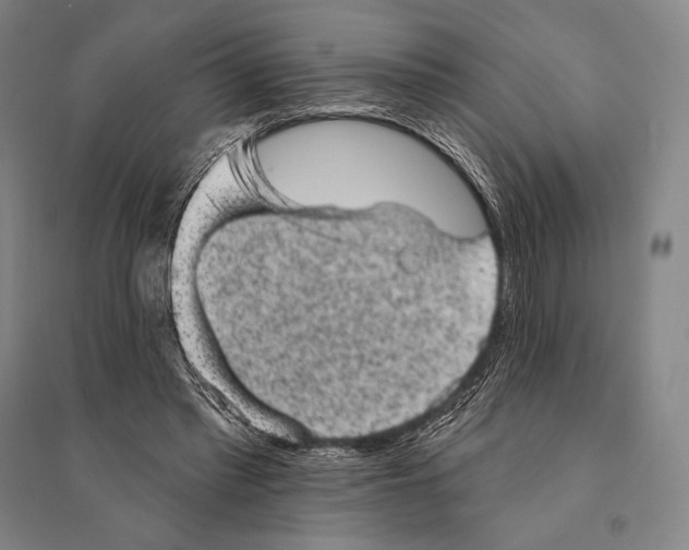 X0000095510397200801111418