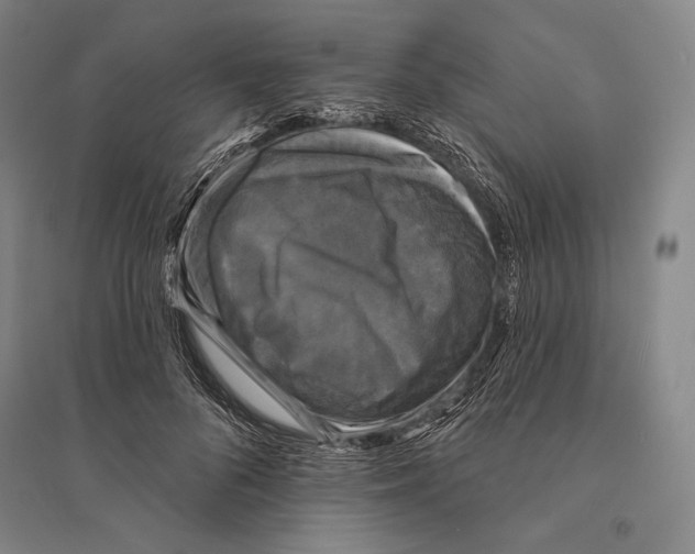 X0000095510696200801111413