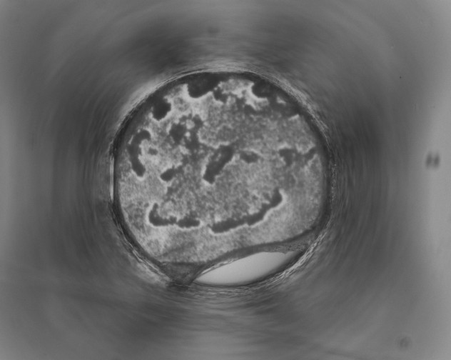 X0000095511171200801111407