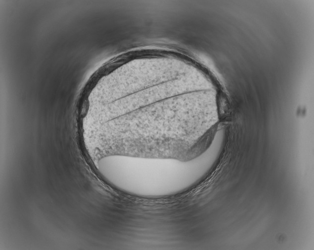 X0000095511360200801111404