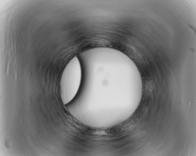 X0000095520177200712140918
