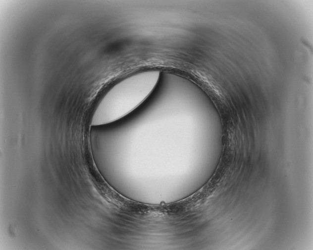 X0000095520592200712140911