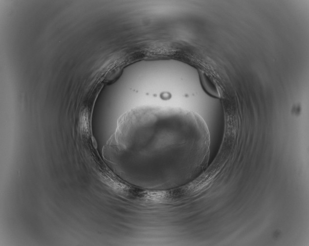 X0000095520143200712141454