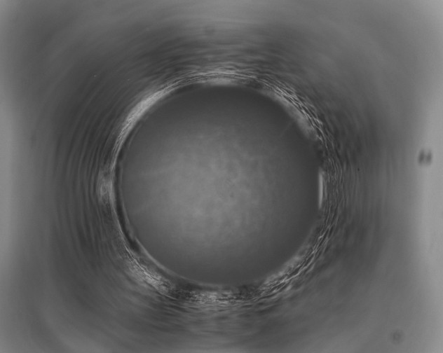 X0000095520147200712141454