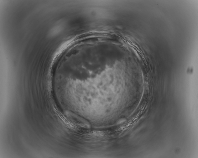 X0000095520149200712141454