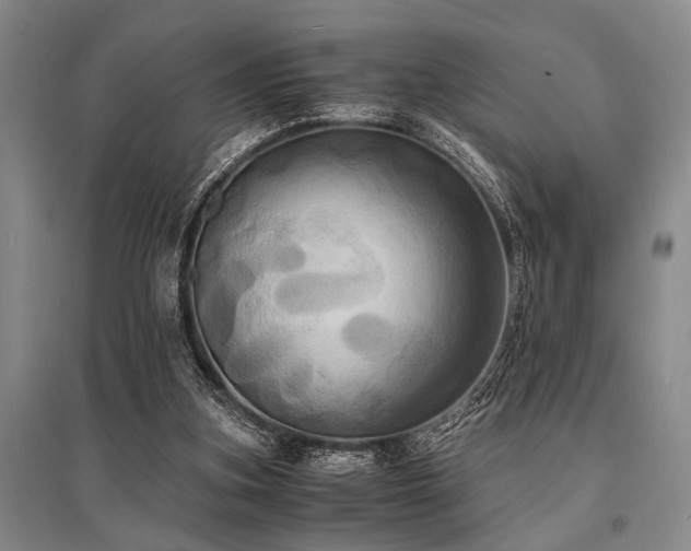 X0000095520155200712141454