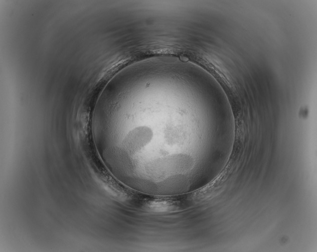 X0000095520171200712141454