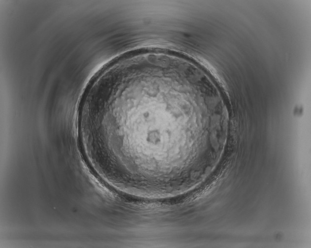 X0000095520791200712141445