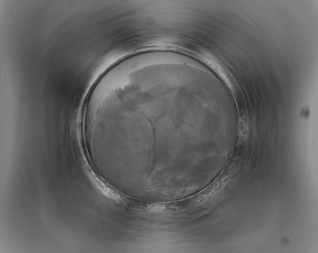 X0000095521098200712141440