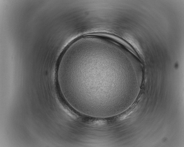 X0000095520156200712211311