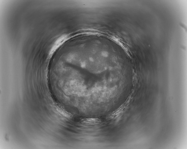 X0000095520151200712281508