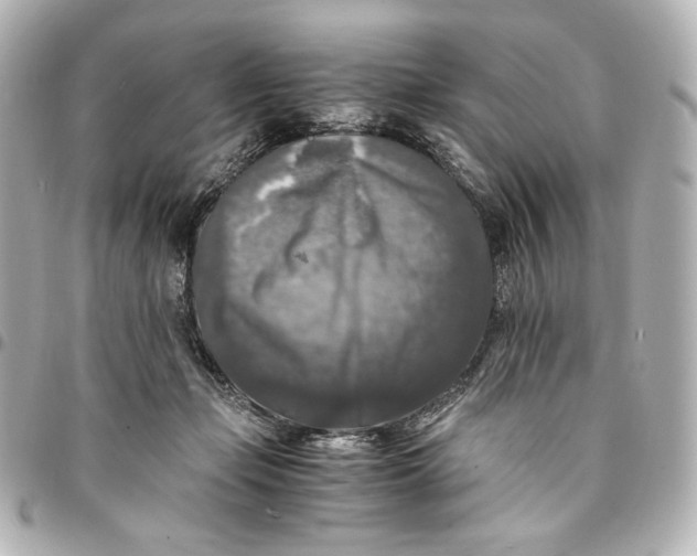 X0000095520365200712281505