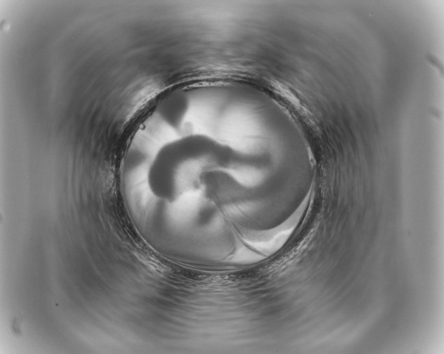 X0000095521259200712281452