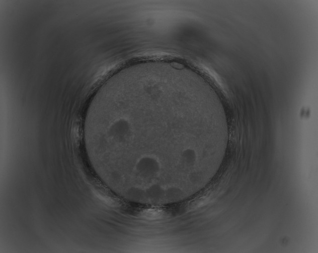 X0000095520119200801041232