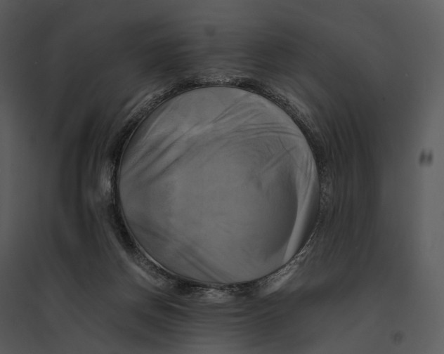 X0000095520166200801041231