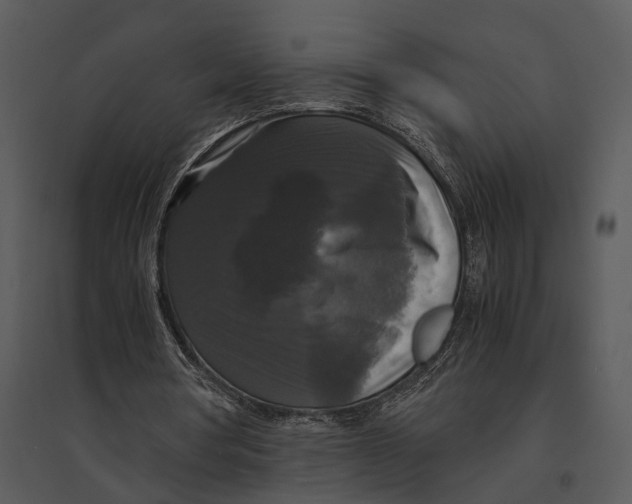 X0000095520386200801041228