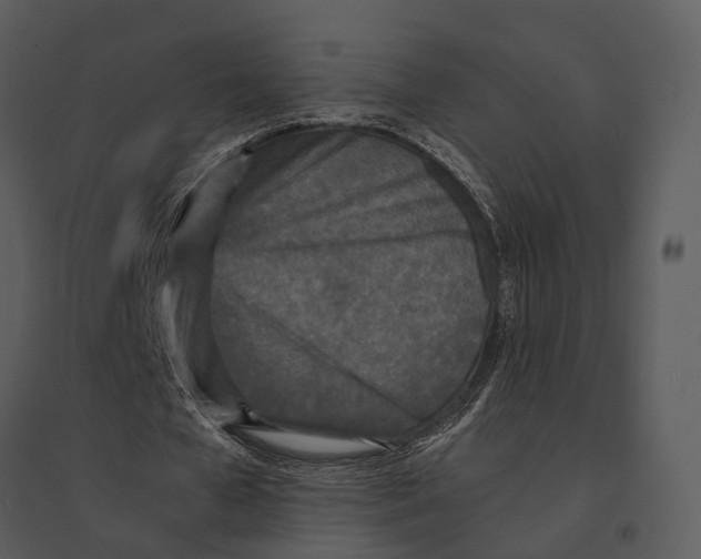 X0000095520577200801041225