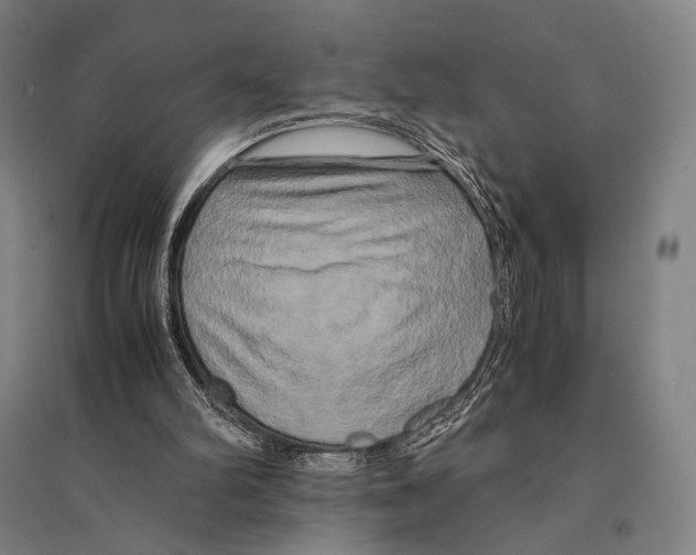 X0000095520102200801111445