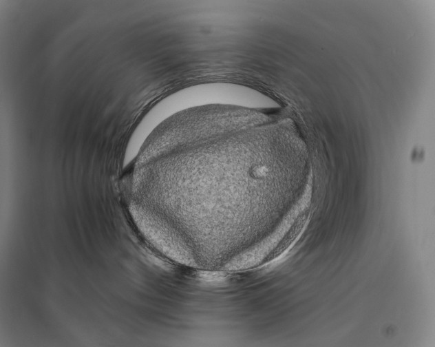X0000095520144200801111445