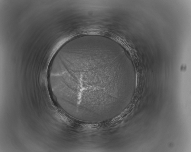 X0000095520147200801111444