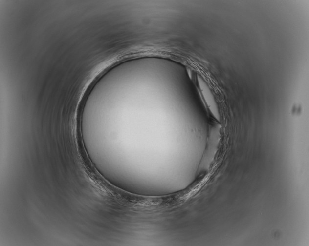 X0000095520148200801111444