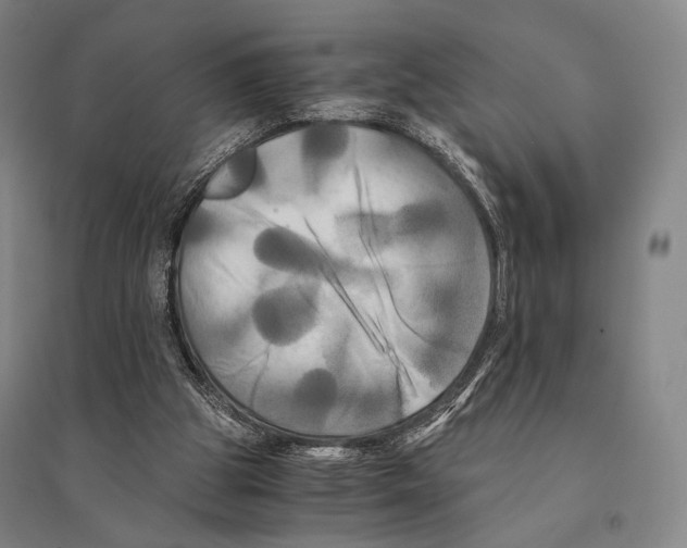 X0000095520153200801111444