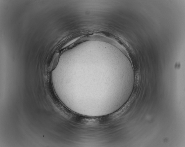 X0000095520170200801111444