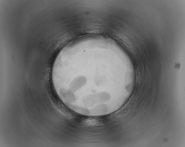 X0000095520171200801111444