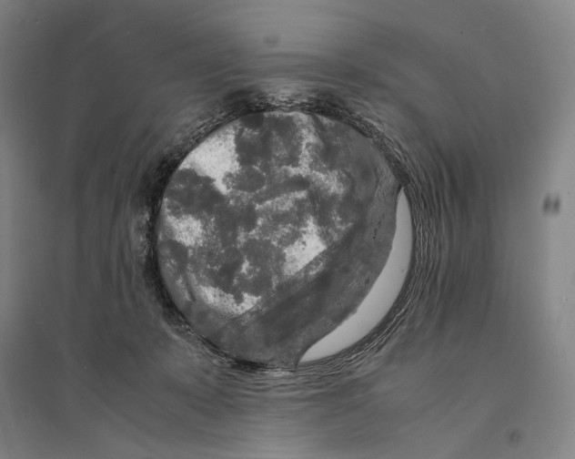 X0000095520319200801111442