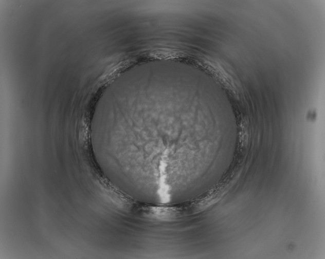 X0000095520371200801111441