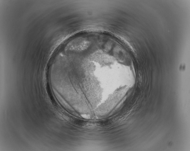 X0000095520487200801111440