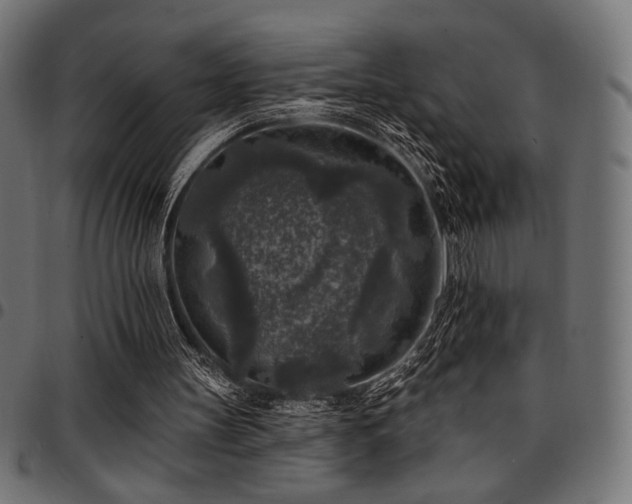 X0000095530147200712141510