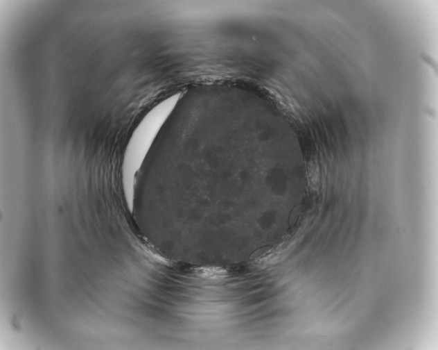 X0000095530719200712281522