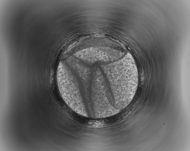 X0000095530559200801111415