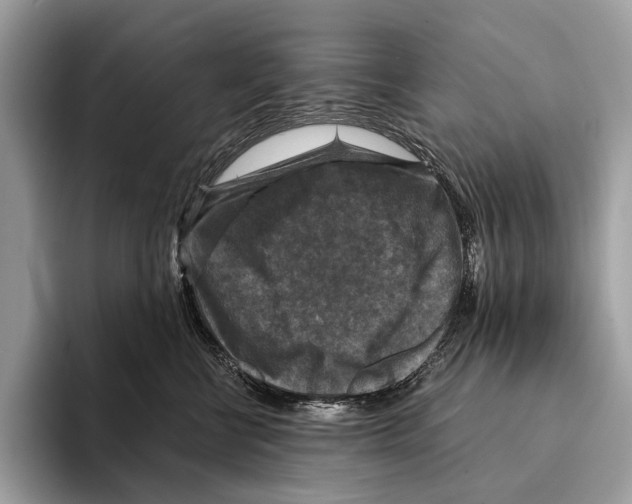 X0000095530570200801111415