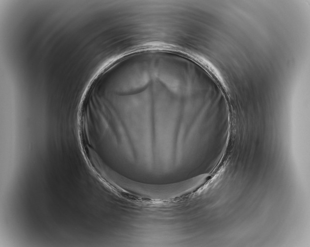 X0000095531381200801111404