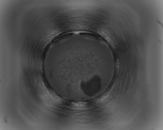 X0000095540359200712141529