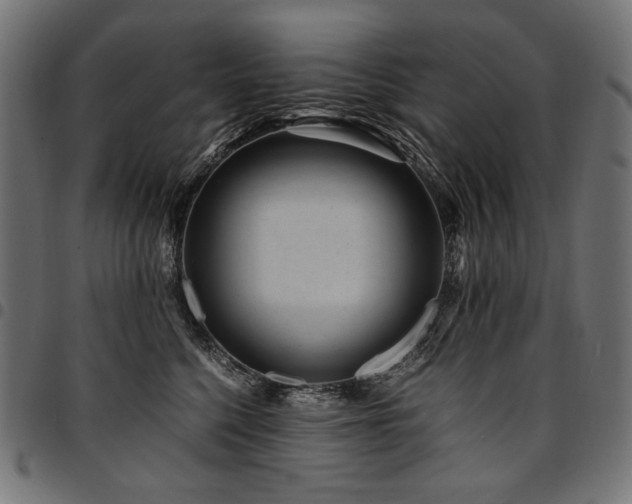 X0000095540568200712141527