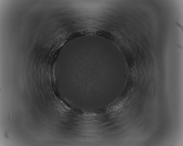 X0000095540818200712141522